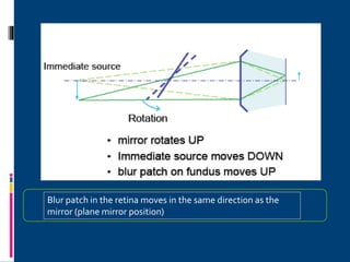 Blur patch in the retina moves in the same direction as the
mirror (plane mirror position)
 