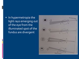  In hypermetropia the
light rays emerging out
of the eye from the
illuminated spot of the
fundus are divergent
 
