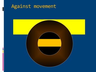 Against movement
 