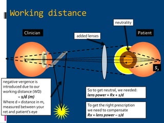 Clinician
S2
Patient
Working distance
neutrality
negative vergence is
introduced due to our
working distance (WD)
= 1/d (m)
Where d = distance in m,
measured between your
ret and patient’s eye
added lenses
To get the right prescription
we need to compensate
Rx = lens power – 1/d
So to get neutral, we needed:
lens power = Rx + 1/d
 