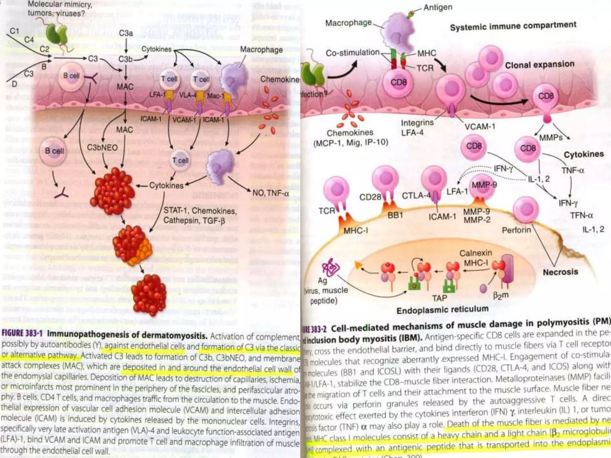 GAIT – lordosis on stance,increased  on toe walking