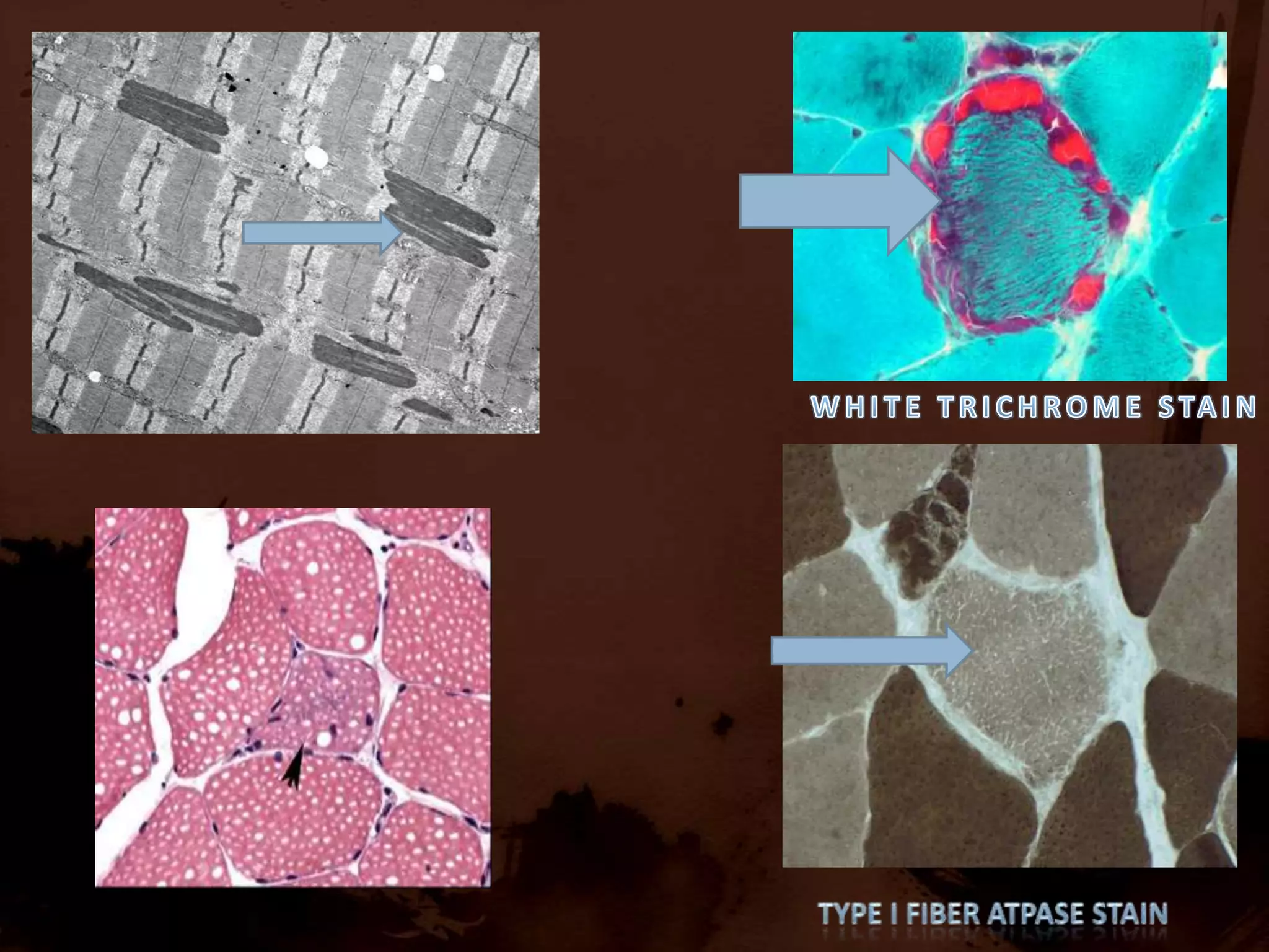Co stimulatory molecules are upregulated . ROLE OF NON IMMUNE FACTORSIBM :