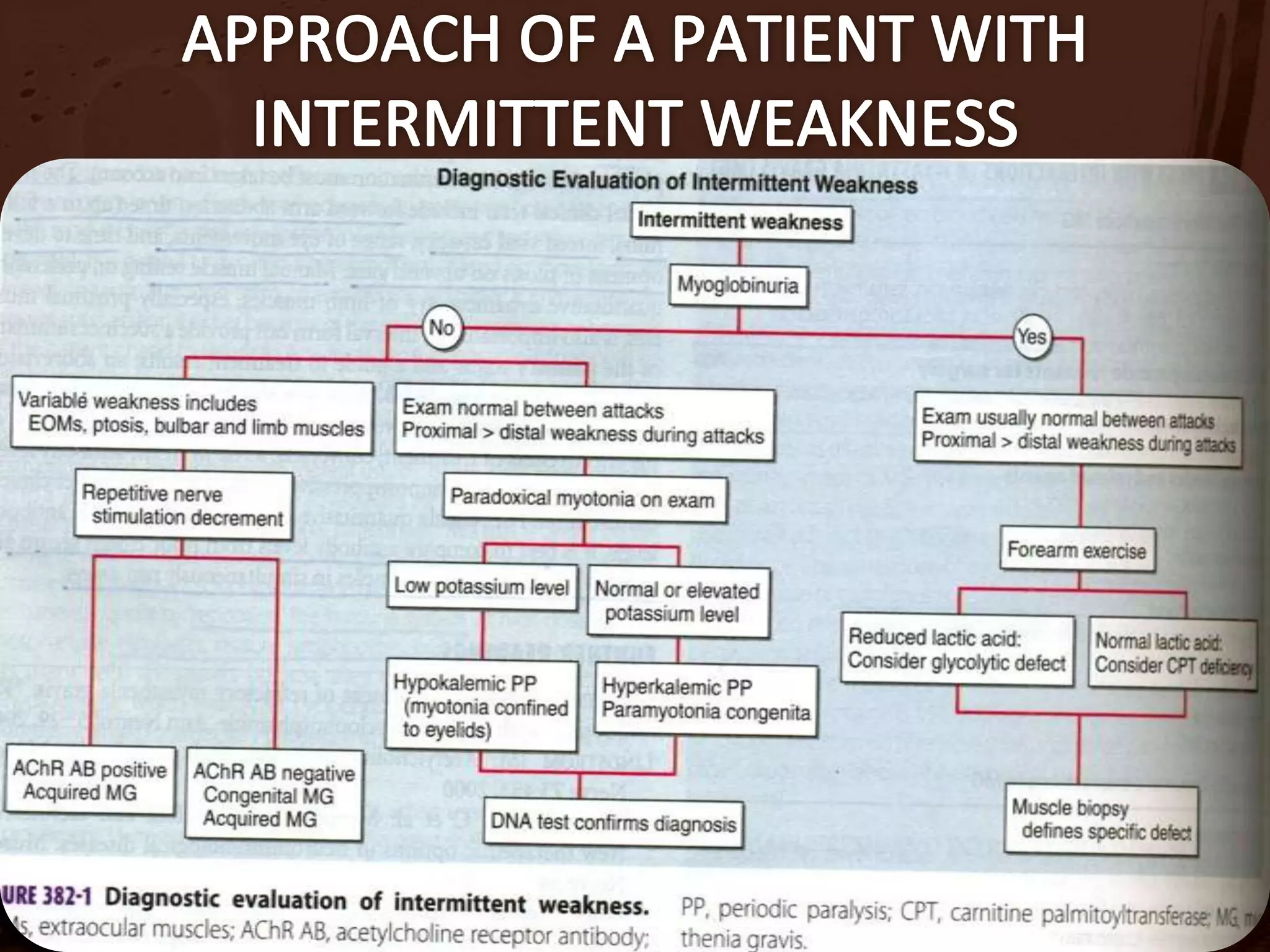 ABSENT fasciculations (+Denervation)