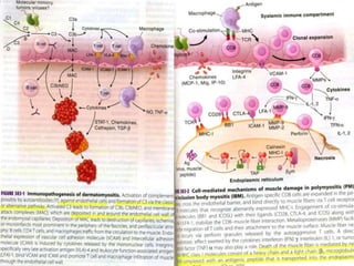 GAIT – lordosis on stance,increased  on toe walking