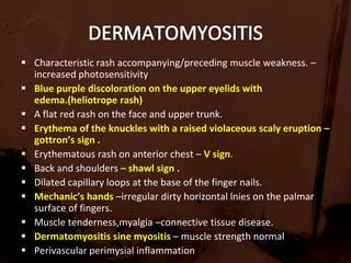 EMG –assess the function of type I fibersnormal in steroid,disuse atrophy