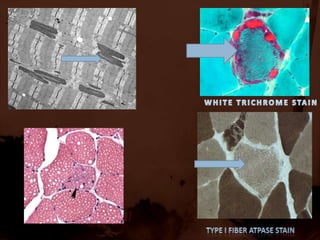 Co stimulatory molecules are upregulated . ROLE OF NON IMMUNE FACTORSIBM :