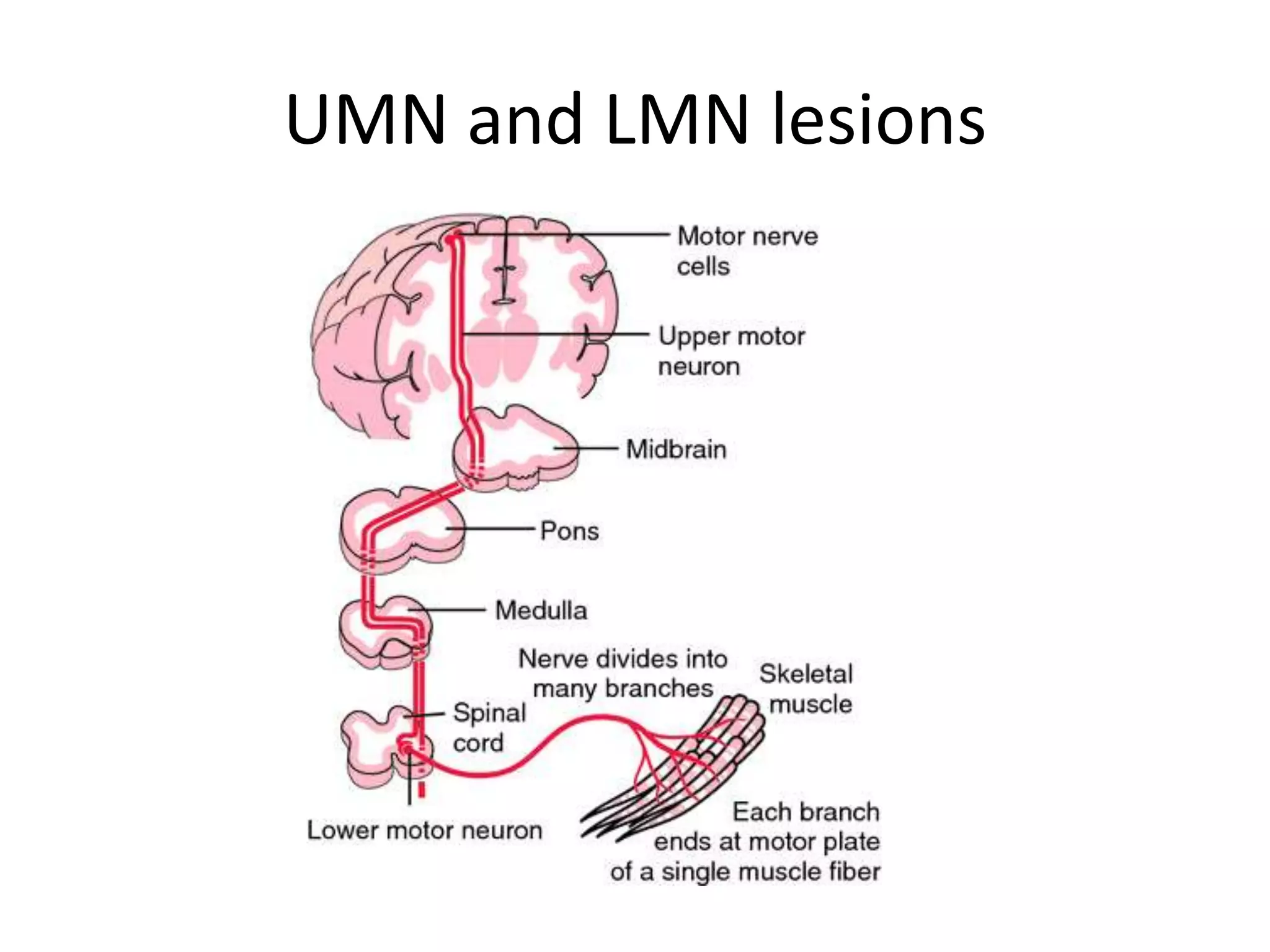 UMN and LMN lesions
 