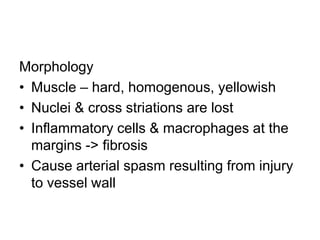 Morphology
• Muscle – hard, homogenous, yellowish
• Nuclei & cross striations are lost
• Inflammatory cells & macrophages at the
margins -> fibrosis
• Cause arterial spasm resulting from injury
to vessel wall

 