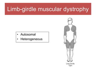 Limb-girdle muscular dystrophy
• Autosomal
• Heterogeneous
 