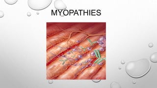 MYOPATHIES
 