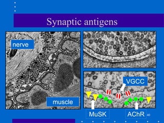 40
Synaptic antigens
nerve
muscle
VGCC
AChR
MuSK
 