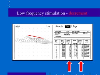 Low frequency stimulation - decrement
 