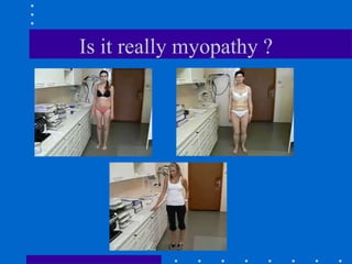 Is it really myopathy ?
 