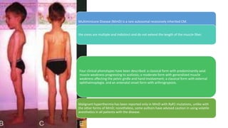 Multiminicore Disease (MmD) is a rare autosomal recessively inherited CM.
the cores are multiple and indistinct and do not extend the length of the muscle fiber.
Four clinical phenotypes have been described: a classical form with predominantly axial
muscle weakness progressing to scoliosis; a moderate form with generalized muscle
weakness affecting the pelvic girdle and hand involvement; a classical form with external
ophthalmoplegia. and an antenatal onset form with arthrogryposis.
Malignant hyperthermia has been reported only in MmD with RyR1 mutations, unlike with
the other forms of MmD; nonetheless, some authors have advised caution in using volatile
anesthetics in all patients with the disease.
 