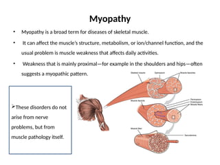 Myopathic Pattern Comprehensive Overview of Myopathy: Causes, Diagnosis, and ...