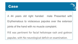 A 44 years old right handed male Presented with
Erythematous to violaceous papules over the extensor
joints of the hand with no muscle complaint.
P/E was pertinent for facial heliotrope rash and gottron
papules. with No neurological deficit on examination.
Case
 