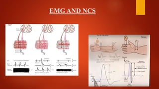 EMG AND NCS
 
