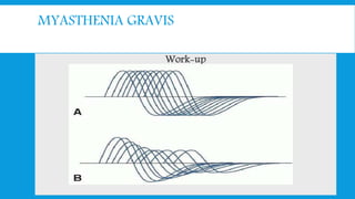MYASTHENIA GRAVIS
Work-up
 