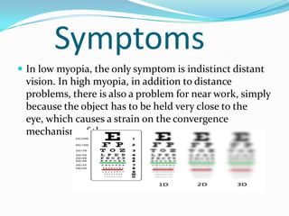 Poor Distance Vision Myopia | PPTX