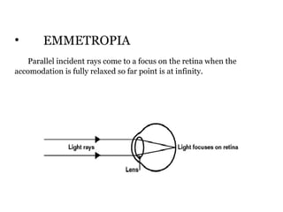 •

EMMETROPIA

Parallel incident rays come to a focus on the retina when the
accomodation is fully relaxed so far point is at infinity.

 