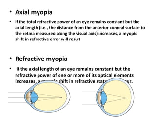 • Axial myopia
• if the total refractive power of an eye remains constant but the
axial length (i.e., the distance from the anterior corneal surface to
the retina measured along the visual axis) increases, a myopic
shift in refractive error will result

• Refractive myopia
•

if the axial length of an eye remains constant but the
refractive power of one or more of its optical elements
increases, a myopic shift in refractive status will occur.

 