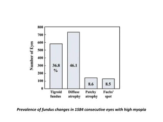Prevalence of fundus changes in 1584 consecutive eyes with high myopia

 