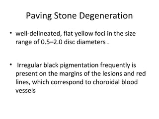 Paving Stone Degeneration
• well-delineated, flat yellow foci in the size
range of 0.5–2.0 disc diameters .
• Irregular black pigmentation frequently is
present on the margins of the lesions and red
lines, which correspond to choroidal blood
vessels

 
