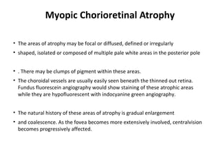 Myopic Chorioretinal Atrophy
• The areas of atrophy may be focal or diffused, defined or irregularly
• shaped, isolated or composed of multiple pale white areas in the posterior pole
• . There may be clumps of pigment within these areas.
• The choroidal vessels are usually easily seen beneath the thinned out retina.
Fundus fluorescein angiography would show staining of these atrophic areas
while they are hypofluorescent with indocyanine green angiography.
• The natural history of these areas of atrophy is gradual enlargement
• and coalescence. As the fovea becomes more extensively involved, centralvision
becomes progressively affected.

 