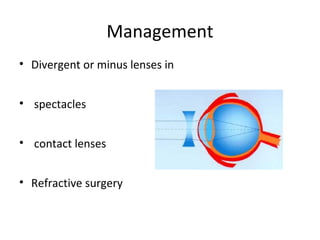 Management
• Divergent or minus lenses in
• spectacles
• contact lenses
• Refractive surgery

 
