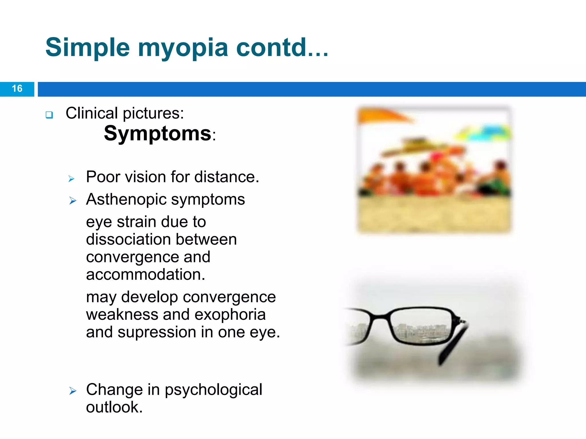 Simple myopia contd…
 Clinical pictures:
Symptoms:
 Poor vision for distance.
 Asthenopic symptoms
eye strain due to
dissociation between
convergence and
accommodation.
may develop convergence
weakness and exophoria
and supression in one eye.
 Change in psychological
outlook.
16
 