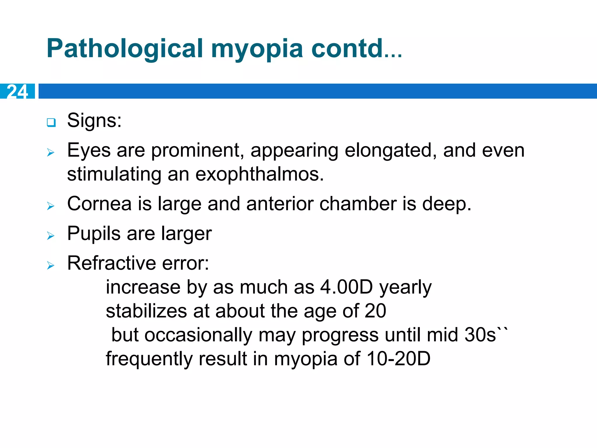 MYOPIA | PPTX