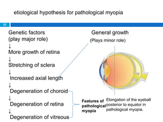 22
Genetic factors General growth
(play major role)
↓
More growth of retina
↓
Stretching of sclera
↓
Increased axial length
↓
Degeneration of choroid
↓
Degeneration of retina
↓
Degeneration of vitreous
Features of
pathological
myopia
etiological hypothesis for pathological myopia
(Plays minor role)
Elongation of the eyeball
posterior to equator in
pathological myopia.
 