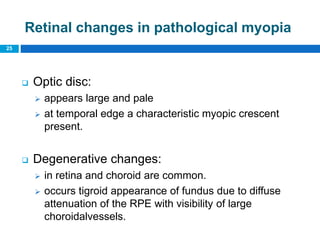 25
Retinal changes in pathological myopia
 Optic disc:
 appears large and pale
 at temporal edge a characteristic myopic crescent
present.
 Degenerative changes:
 in retina and choroid are common.
 occurs tigroid appearance of fundus due to diffuse
attenuation of the RPE with visibility of large
choroidalvessels.
 