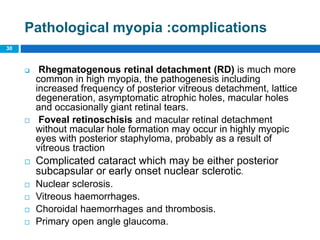 30
Pathological myopia :complications
 Rhegmatogenous retinal detachment (RD) is much more
common in high myopia, the pathogenesis including
increased frequency of posterior vitreous detachment, lattice
degeneration, asymptomatic atrophic holes, macular holes
and occasionally giant retinal tears.
 Foveal retinoschisis and macular retinal detachment
without macular hole formation may occur in highly myopic
eyes with posterior staphyloma, probably as a result of
vitreous traction
 Complicated cataract which may be either posterior
subcapsular or early onset nuclear sclerotic.
 Nuclear sclerosis.
 Vitreous haemorrhages.
 Choroidal haemorrhages and thrombosis.
 Primary open angle glaucoma.
 