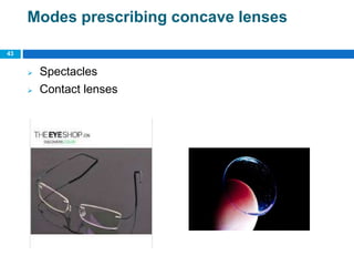 43
Modes prescribing concave lenses
 Spectacles
 Contact lenses
 