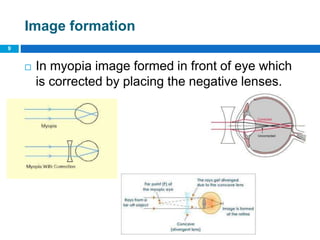 Image formation
 In myopia image formed in front of eye which
is corrected by placing the negative lenses.
9
 