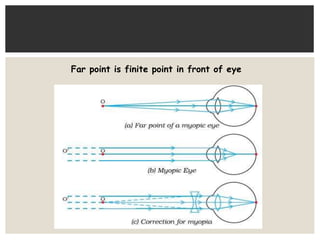 Far point is finite point in front of eye
 