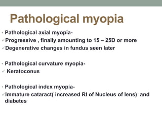 Myopia Ophthalmology ( Quick Review ) | PPT