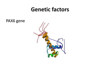 Genetic factors
PAX6 gene
 