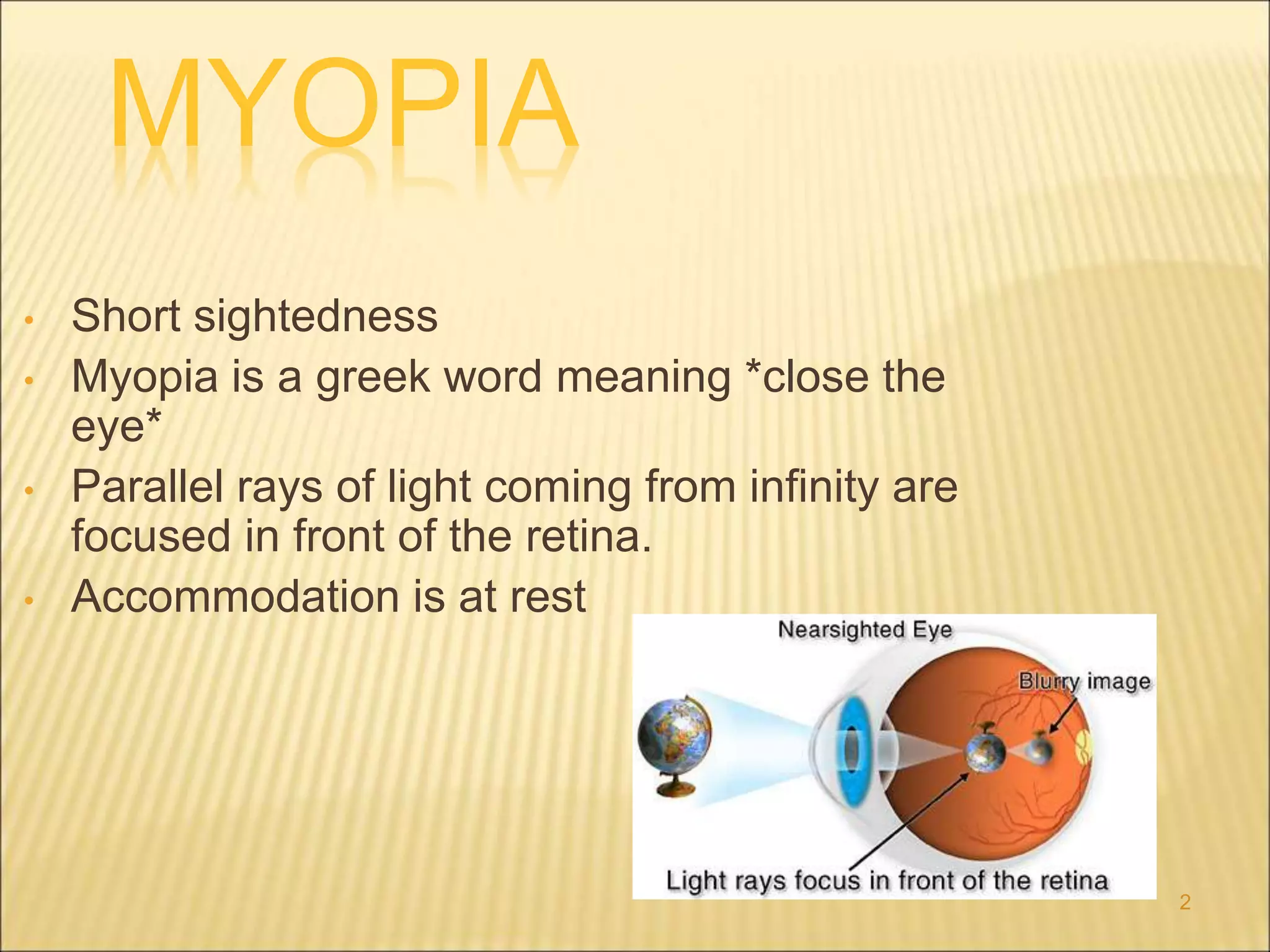 myopia.ppt