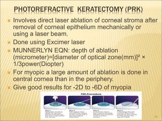 PHOTOREFRACTIVE KERATECTOMY (PRK)
 Involves direct laser ablation of corneal stroma after
removal of corneal epithelium mechanically or
using a laser beam.
 Done using Excimer laser
 MUNNERLYN EQN: depth of ablation
(micrometer)=[diameter of optical zone(mm)]² ×
1/3power(Diopter)
 For myopic a large amount of ablation is done in
central cornea than in the periphery.
 Give good results for -2D to -6D of myopia
30
 
