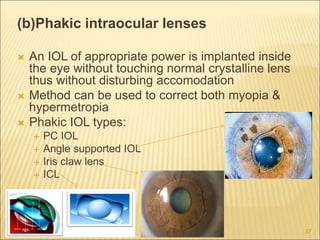 (b)Phakic intraocular lenses
 An IOL of appropriate power is implanted inside
the eye without touching normal crystalline lens
thus without disturbing accomodation
 Method can be used to correct both myopia &
hypermetropia
 Phakic IOL types:
 PC IOL
 Angle supported IOL
 Iris claw lens
 ICL
37
 