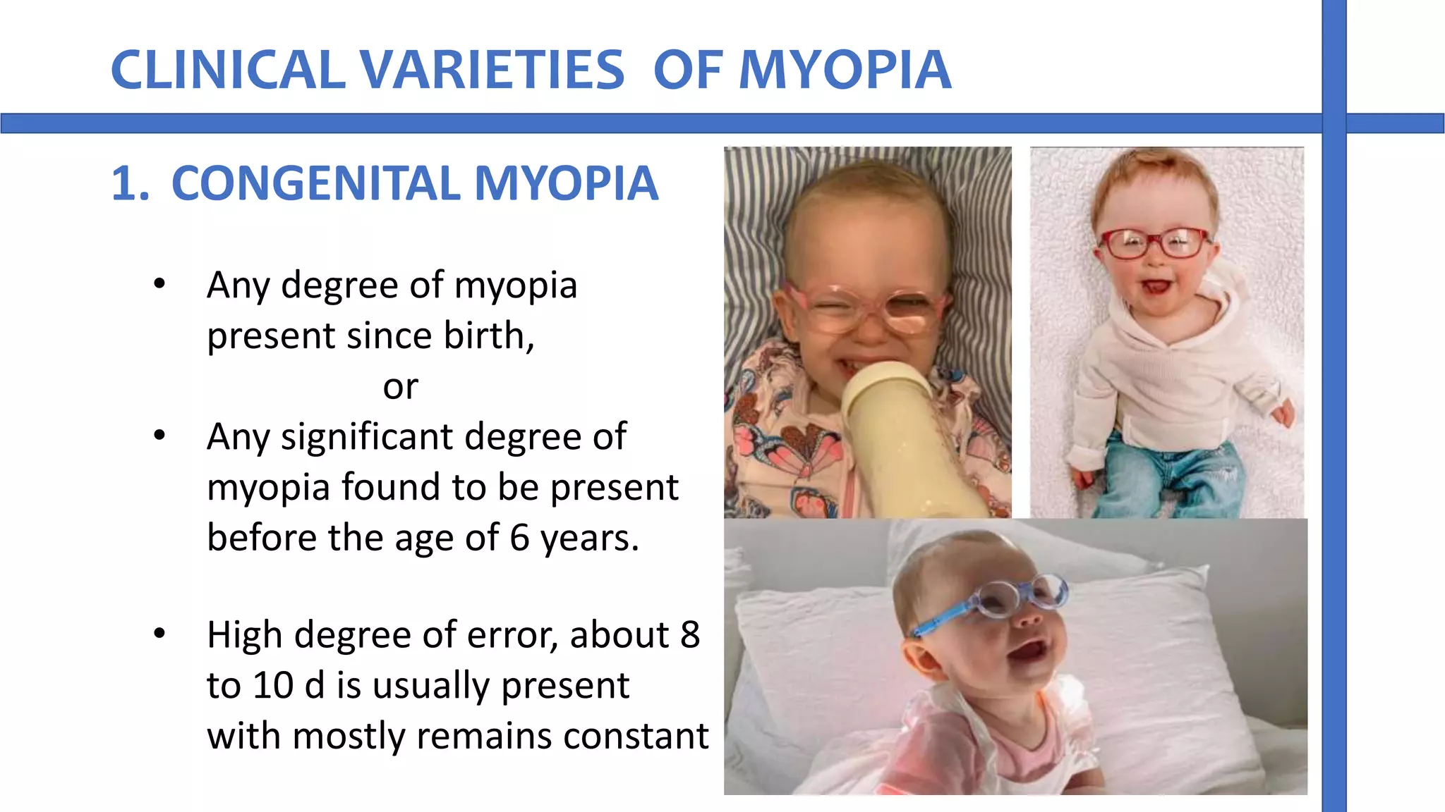 Myopia refractive error of eye | PPT