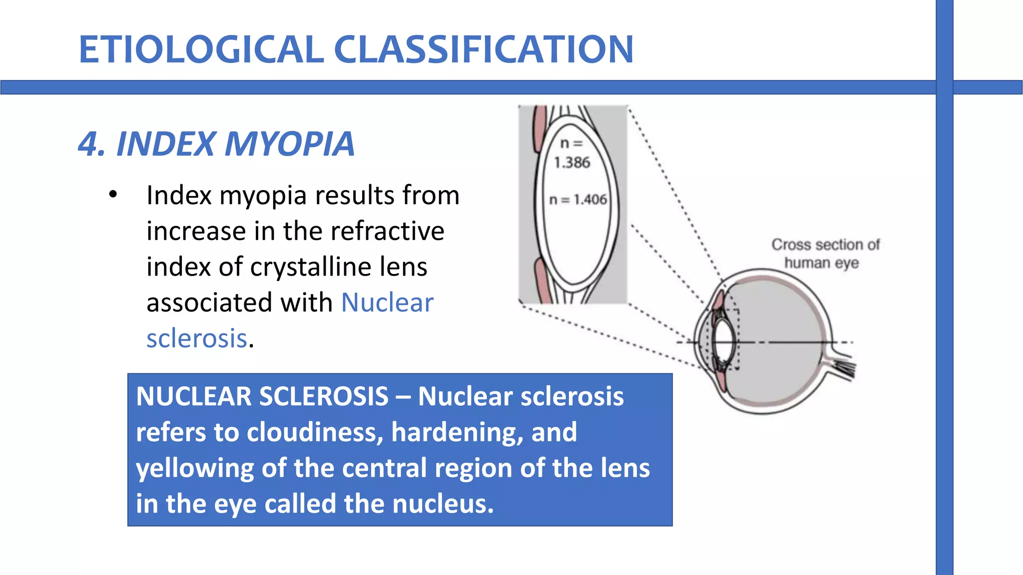 Myopia refractive error of eye | PPT