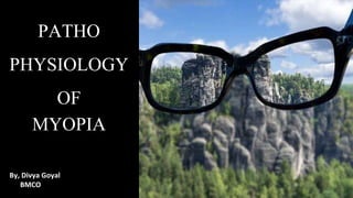 PATHO
PHYSIOLOGY
OF
MYOPIA
By, Divya Goyal
BMCO
 