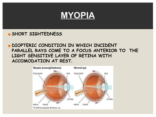 REFRACTIVE ERROR MYOPIA AND ITS MANAGEMENT.pptx