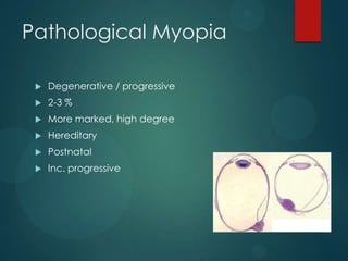 Pathological Myopia


Degenerative / progressive



2-3 %



More marked, high degree



Hereditary



Postnatal



Inc. progressive

 