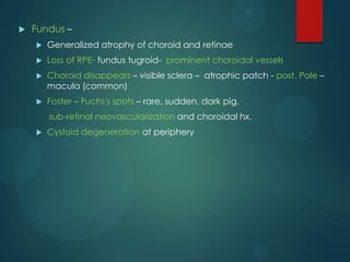 

Fundus –


Generalized atrophy of choroid and retinae



Loss of RPE- fundus tugroid- prominent choroidal vessels



Choroid disappears – visible sclera – atrophic patch - post. Pole –
macula (common)



Foster – Fuchs's spots – rare, sudden, dark pig.
sub-retinal neovascularization and choroidal hx.



Cystoid degeneration at periphery

 