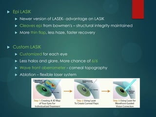 

Epi LASIK



Cleaves epi from bowmen's – structural integrity maintained





Newer version of LASEK- advantage on LASIK
More thin flap, less haze, faster recovery

Custom LASIK


Customized for each eye



Less halos and glare, More chance of 6/6



Wave front aberrometer - corneal topography



Ablation – flexible laser system

 