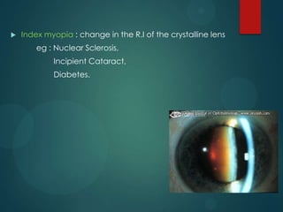 

Index myopia : change in the R.I of the crystalline lens
eg : Nuclear Sclerosis,

Incipient Cataract,
Diabetes.

 